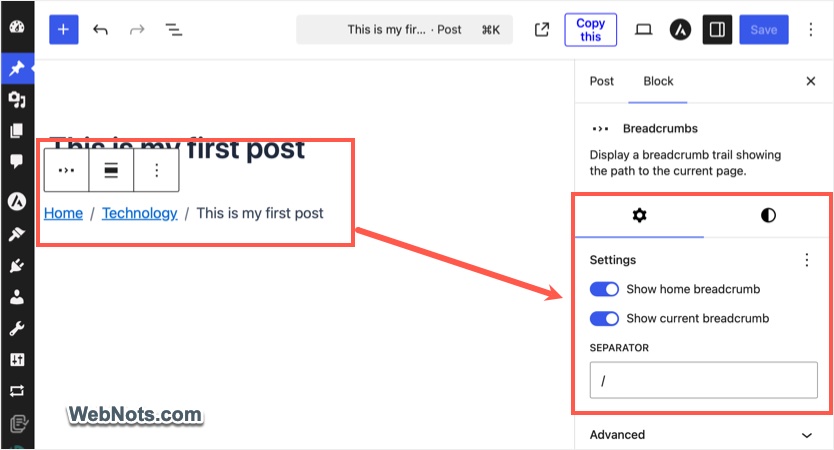 Breadcrumb Block in WordPress